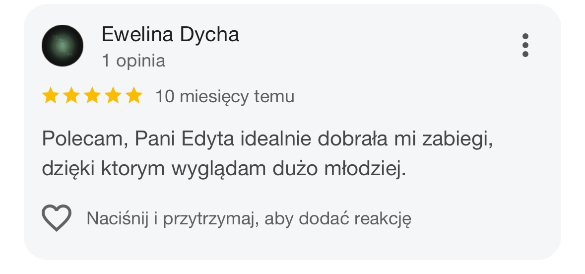 Opinia pacjentki